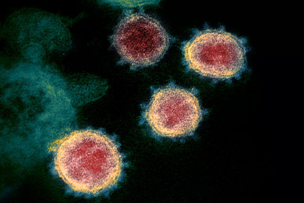 Coronavírus: SARS-CoV-2, o vírus que causa a Covid-19, visto ao microscópio electrónico