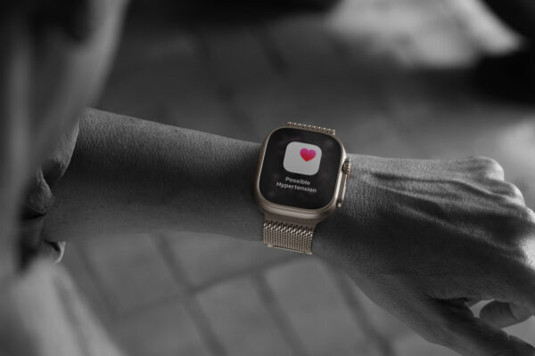 Apple Watch Ultra 3: a chamada que faltava para a tua próxima corrida